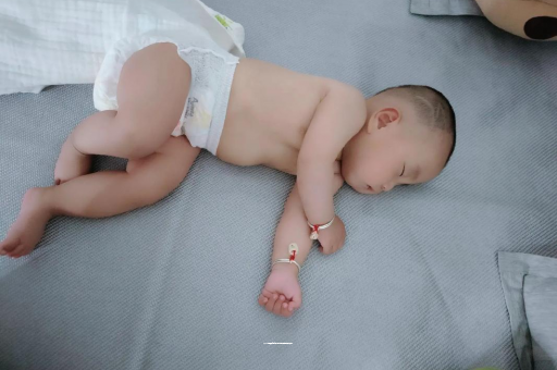长春宝宝头上长痱子